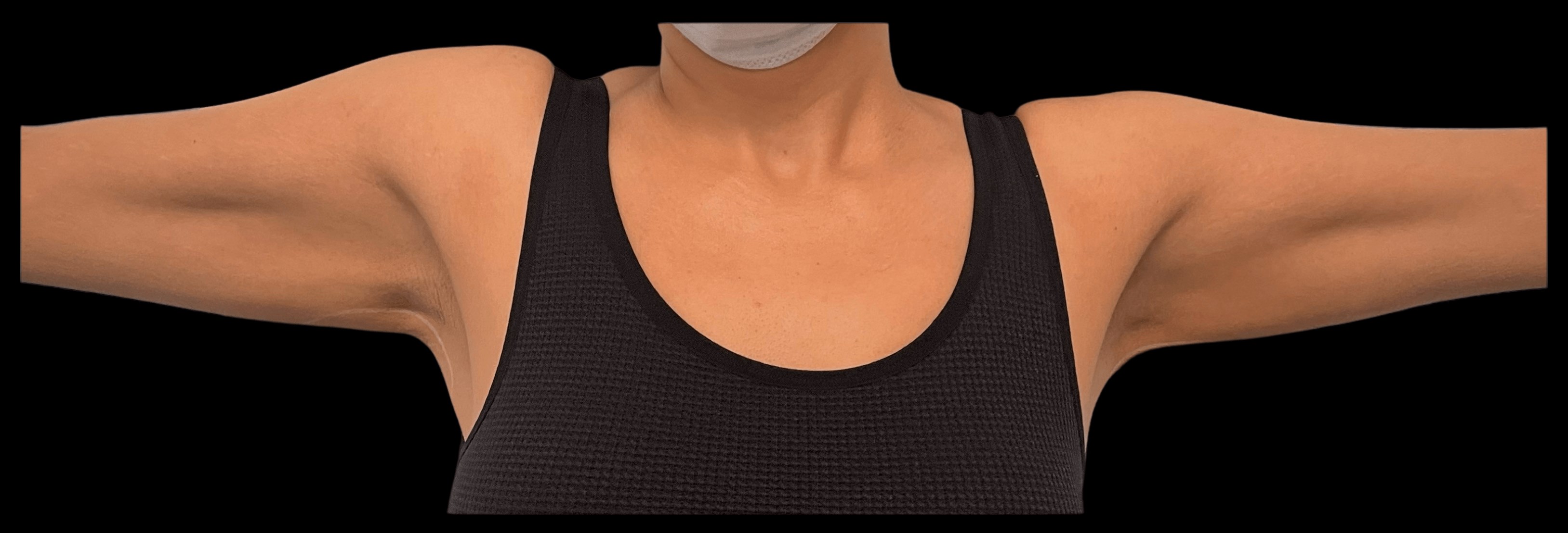 6 weeks of non-invasive treatment with real results